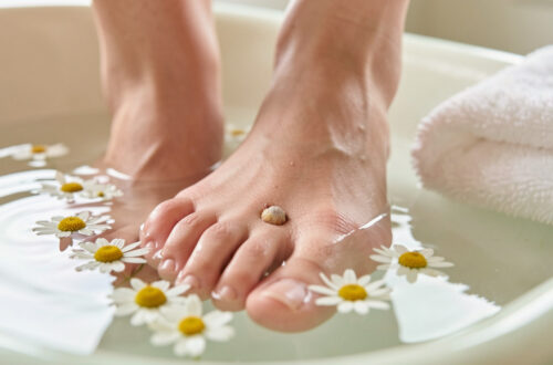 Gros plan non graphique d’un pied de femme présentant un œil-de-perdrix douloureux entre les orteils, accompagné de soins naturels apaisants.